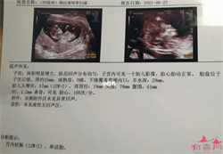 北京助孕婴儿多少钱,试管婴儿流程健康北京家圆,生丰国际助孕中心试管婴儿