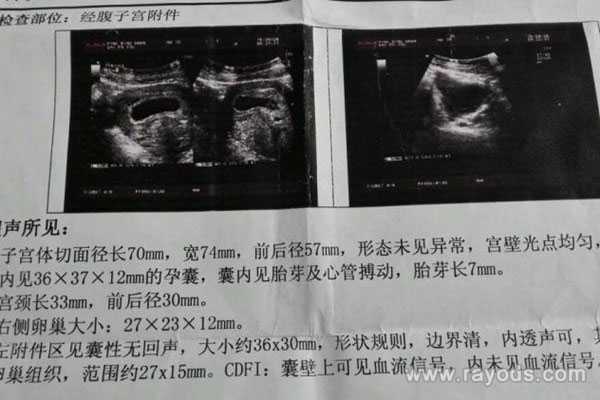 杭州代孕中心公司，供卵助孕公司（杭州